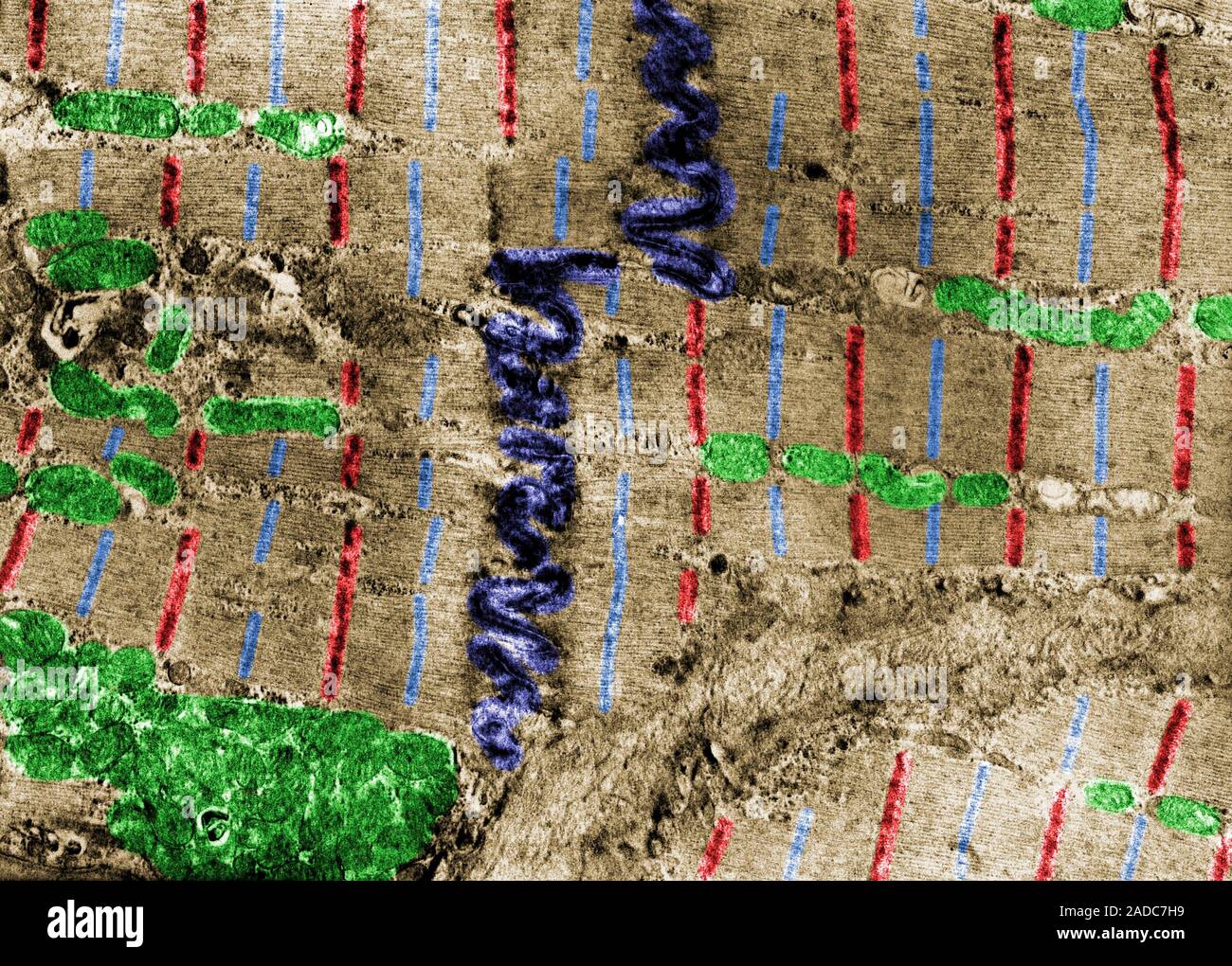 False colour transmission electron micrograph (TEM) showing two heart ...