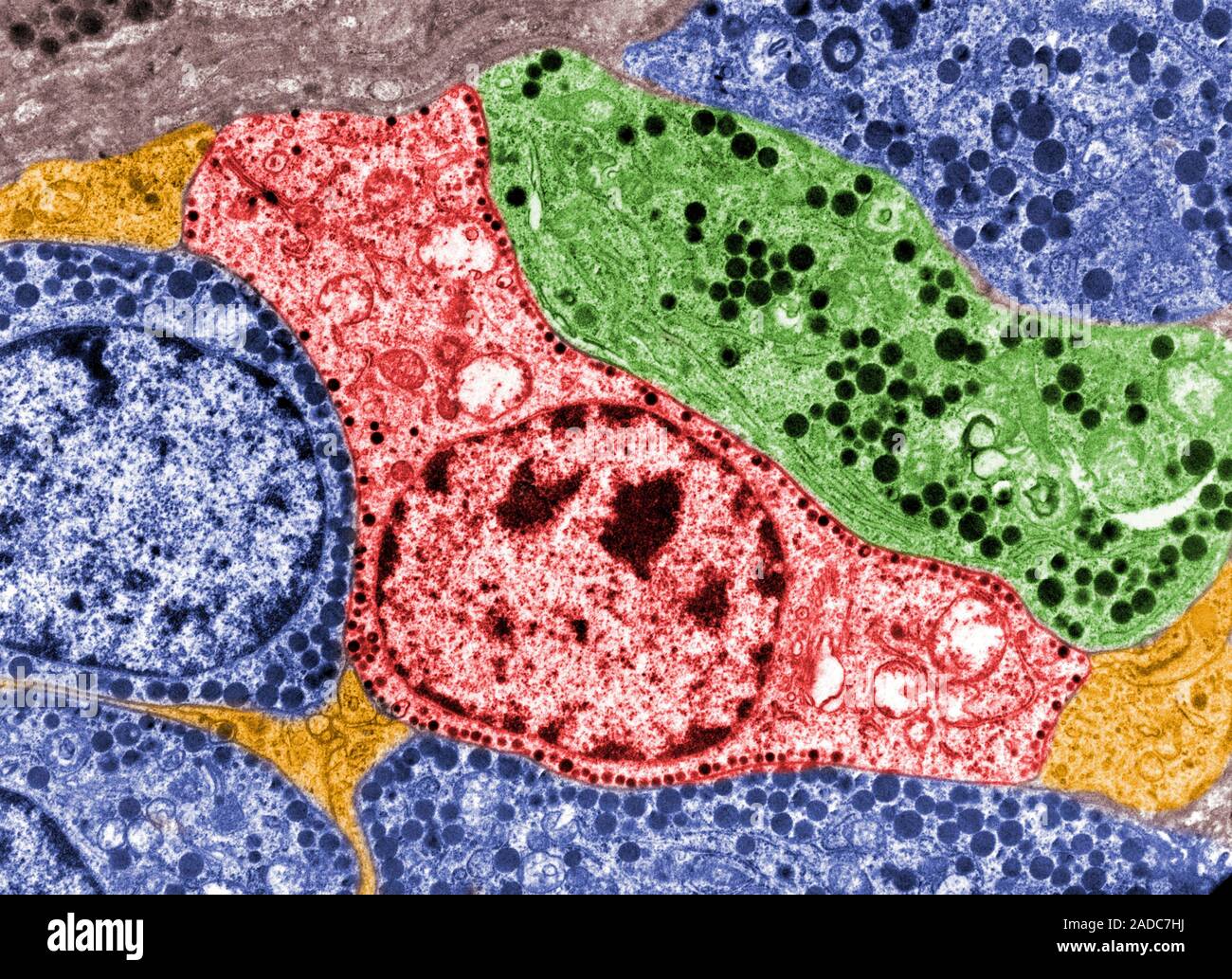 False colour transmission electron micrograph (TEM) showing several ...