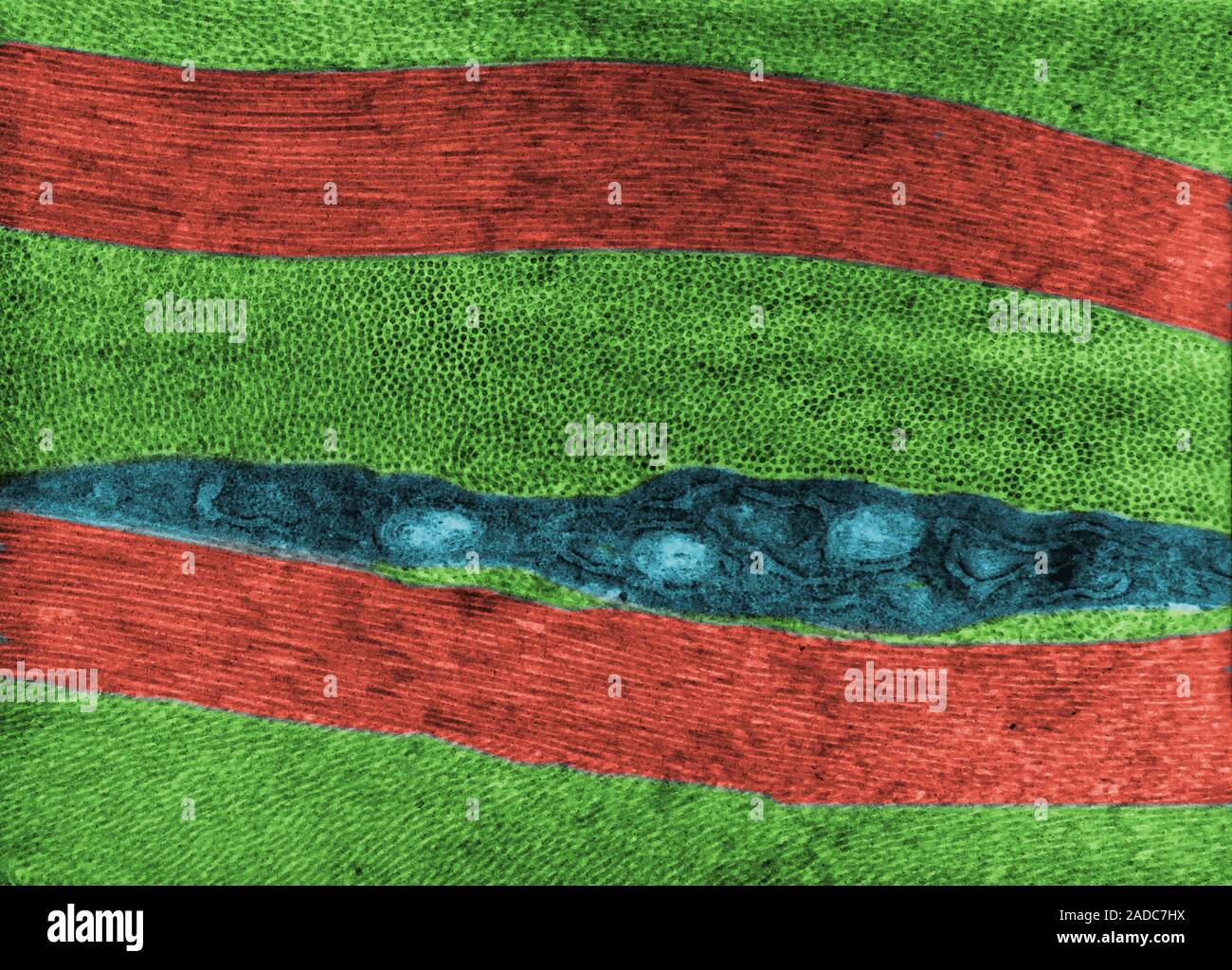 False colour transmission electron micrograph (TEM) showing the typical ...