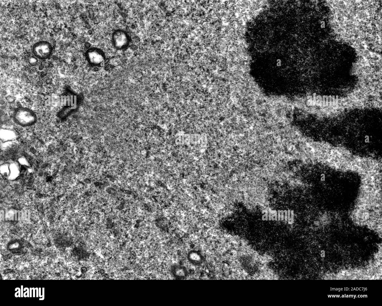 Transmission electron micrograph (TEM) showing metaphase of mitosis ...