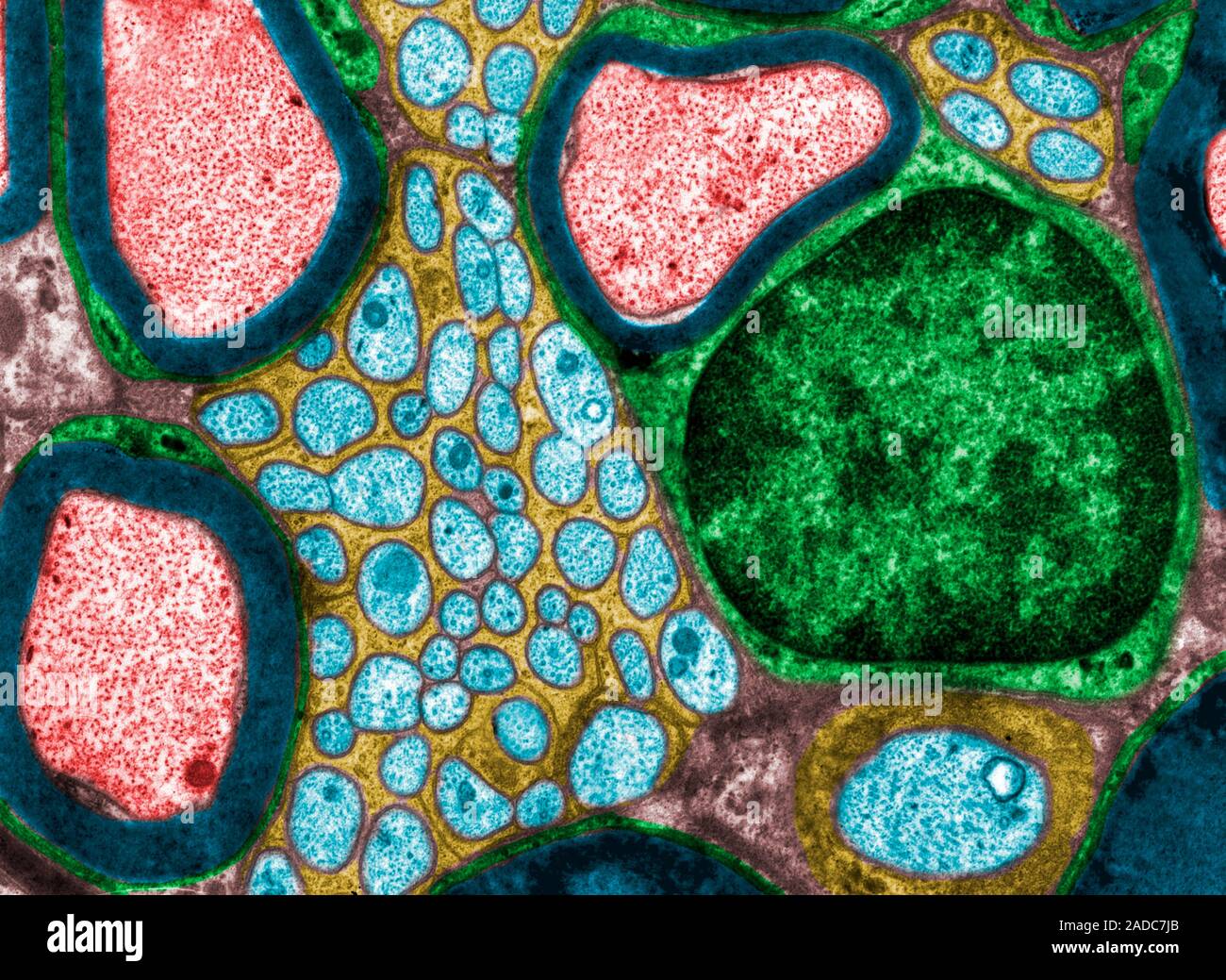 False colour transmission electron micrograph (TEM) of several ...