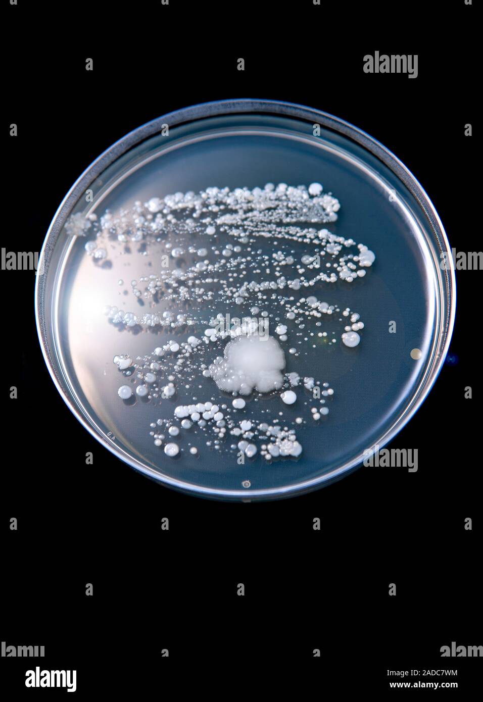 Nose bacteria culture. Petri dish containing a nutrient medium that has