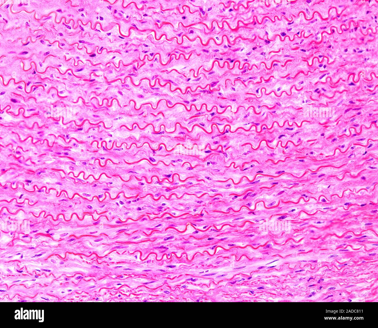 Light micrograph of the tunica media of a human aorta stained with