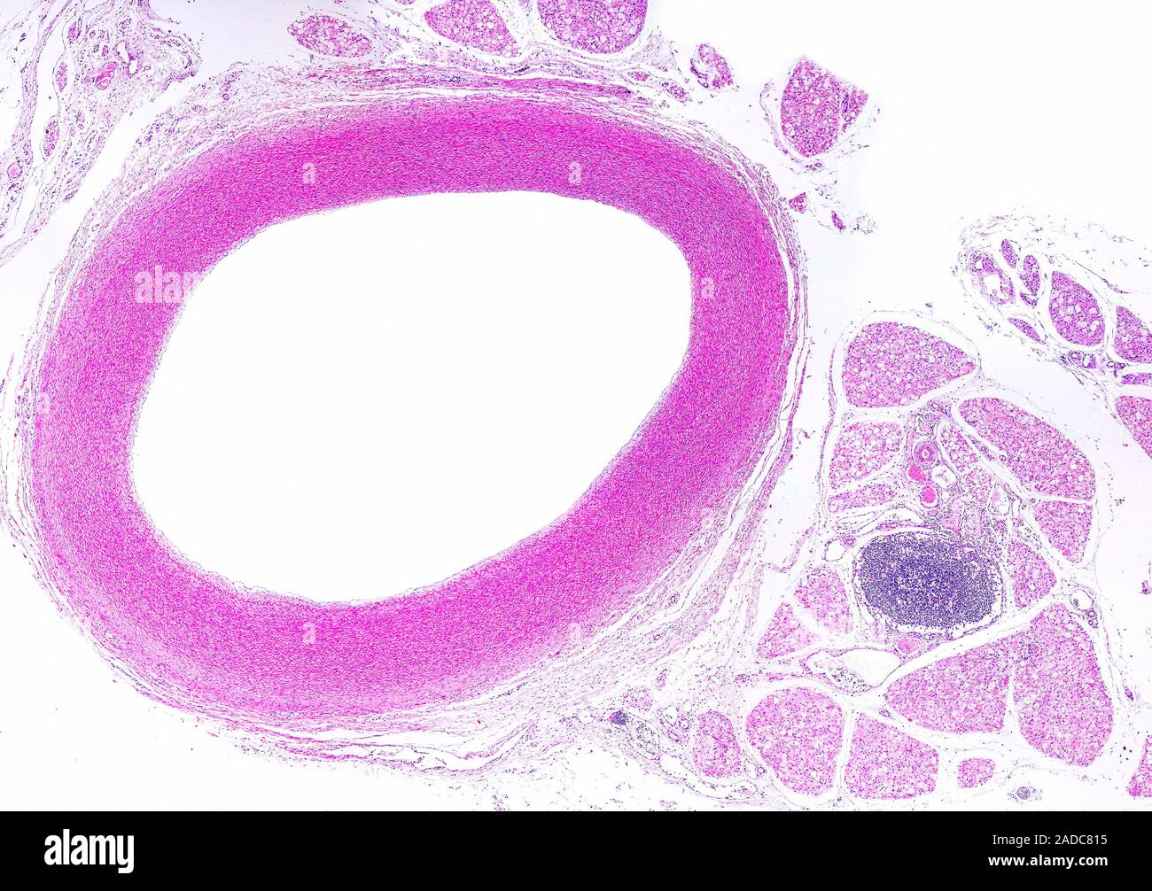 Very low magnification light micrograph of an elastic artery (aorta) in