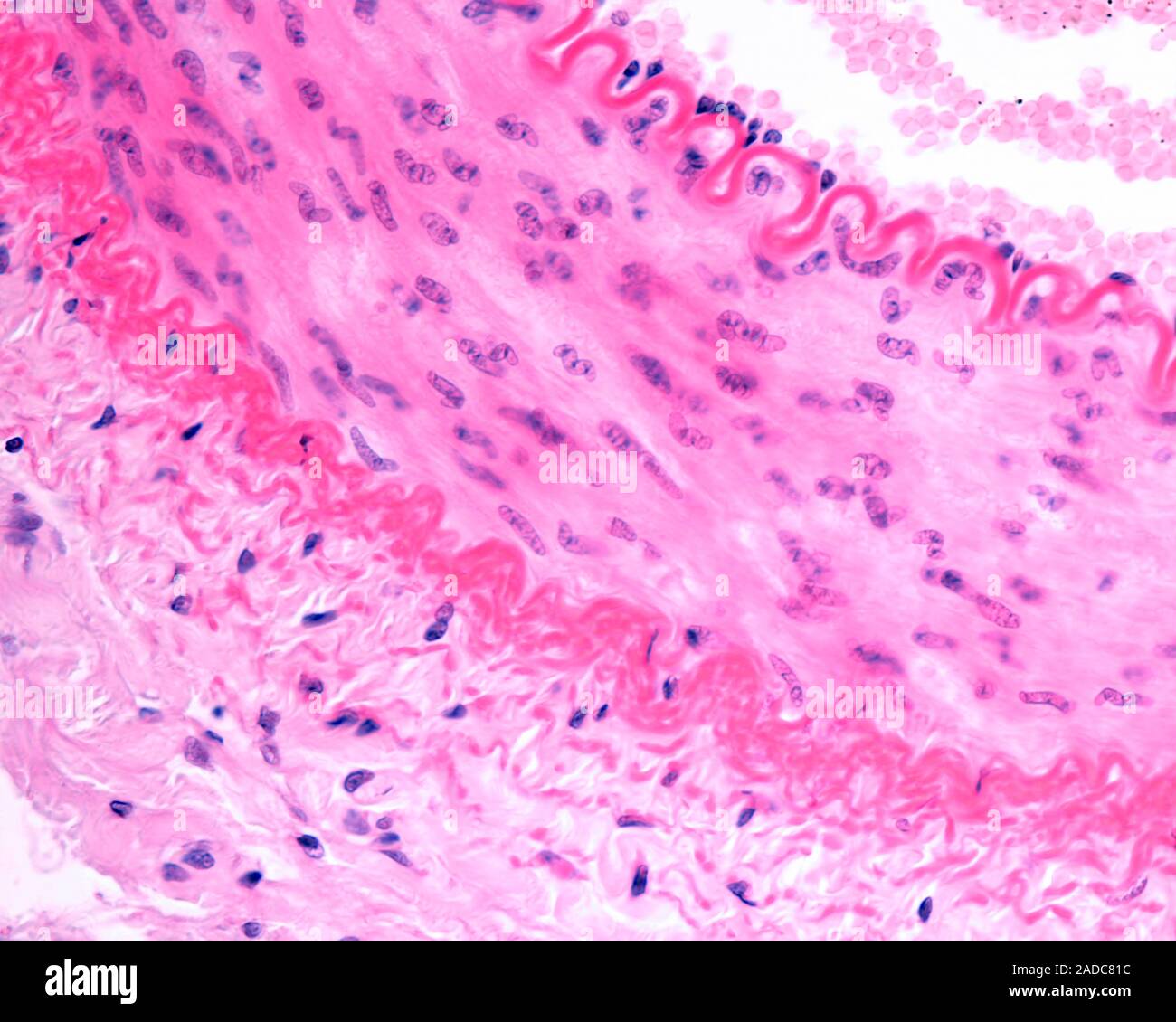 Light micrograph showing a cross section of a muscular artery. The