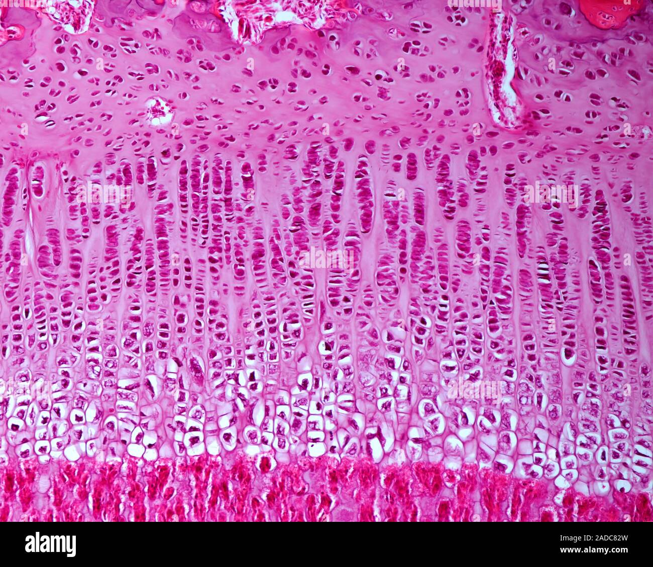 Light Micrograph Of The Epiphyseal Growth Plate Of A Developing Long Bone The Epiphyseal 2964