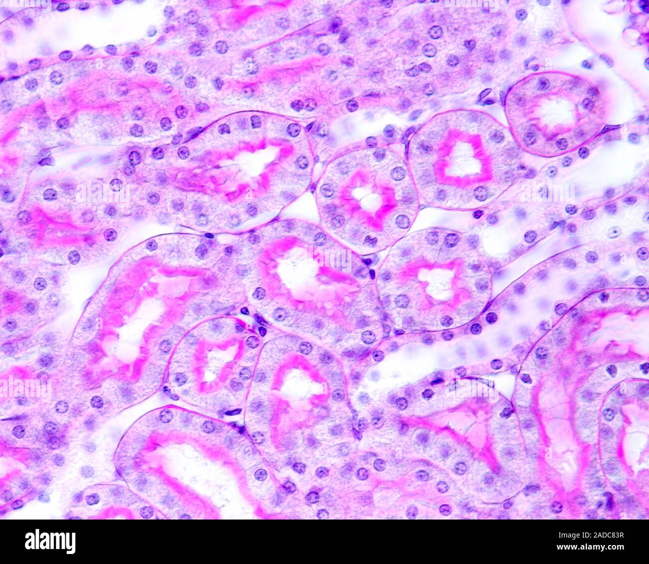 Pas Micrograph High magnification light micrograph of a renal cortex stained with the ...