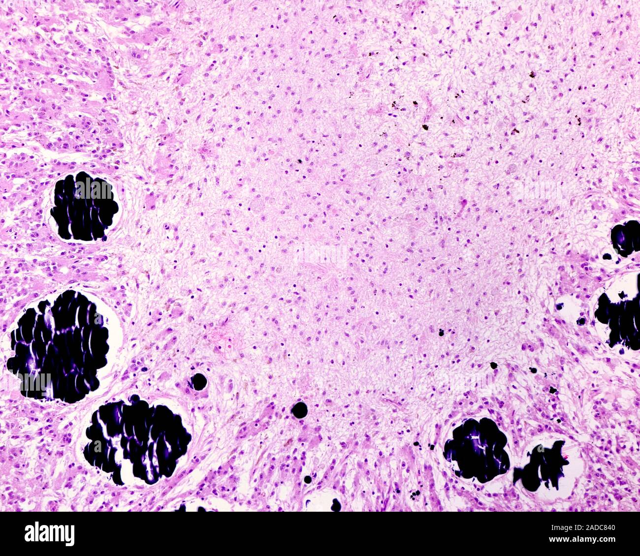 Light micrograph showing one of the features of the senile involution ...