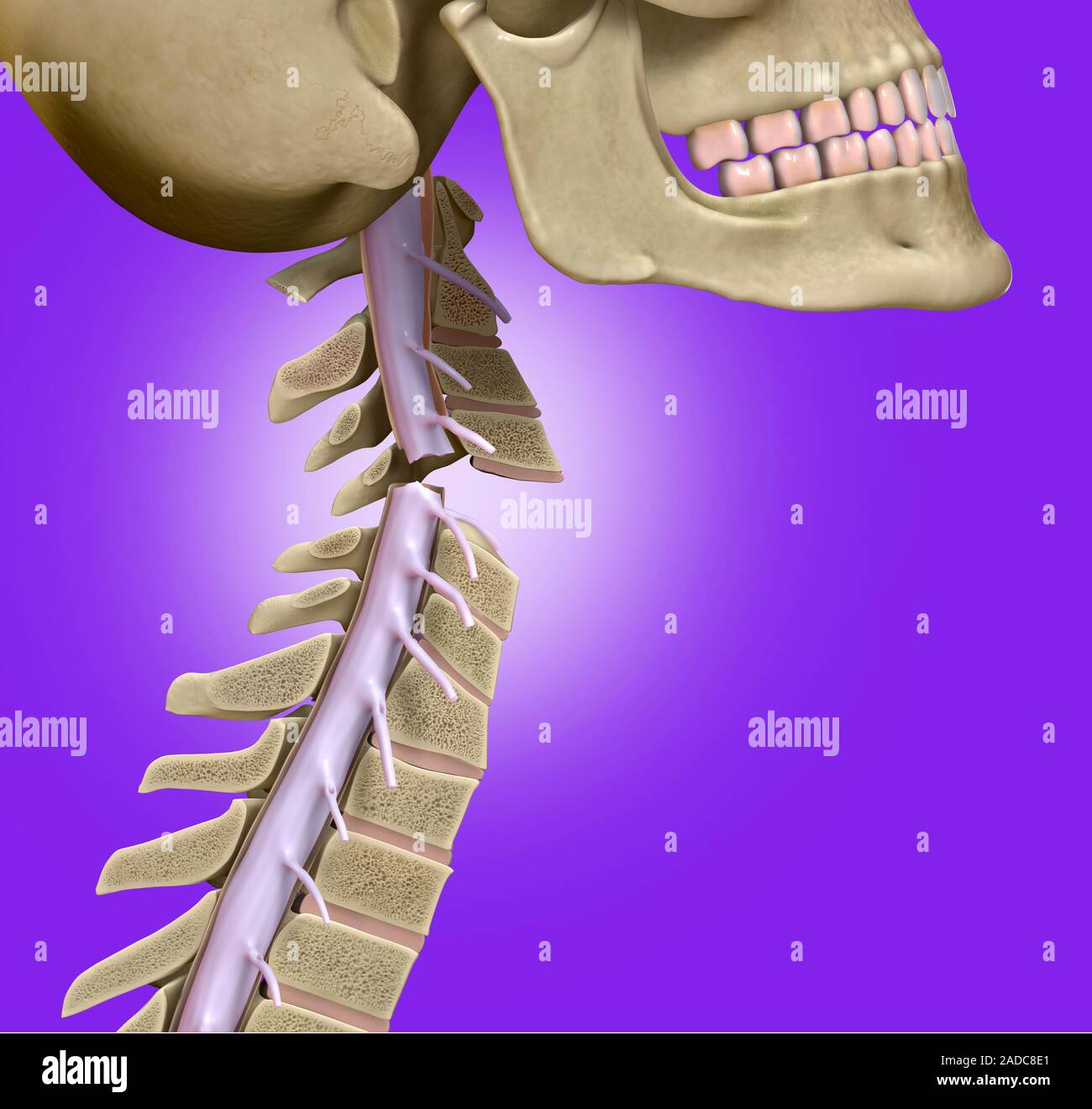 Broken neck. Illustration of a sectioned lateral (side) view of the