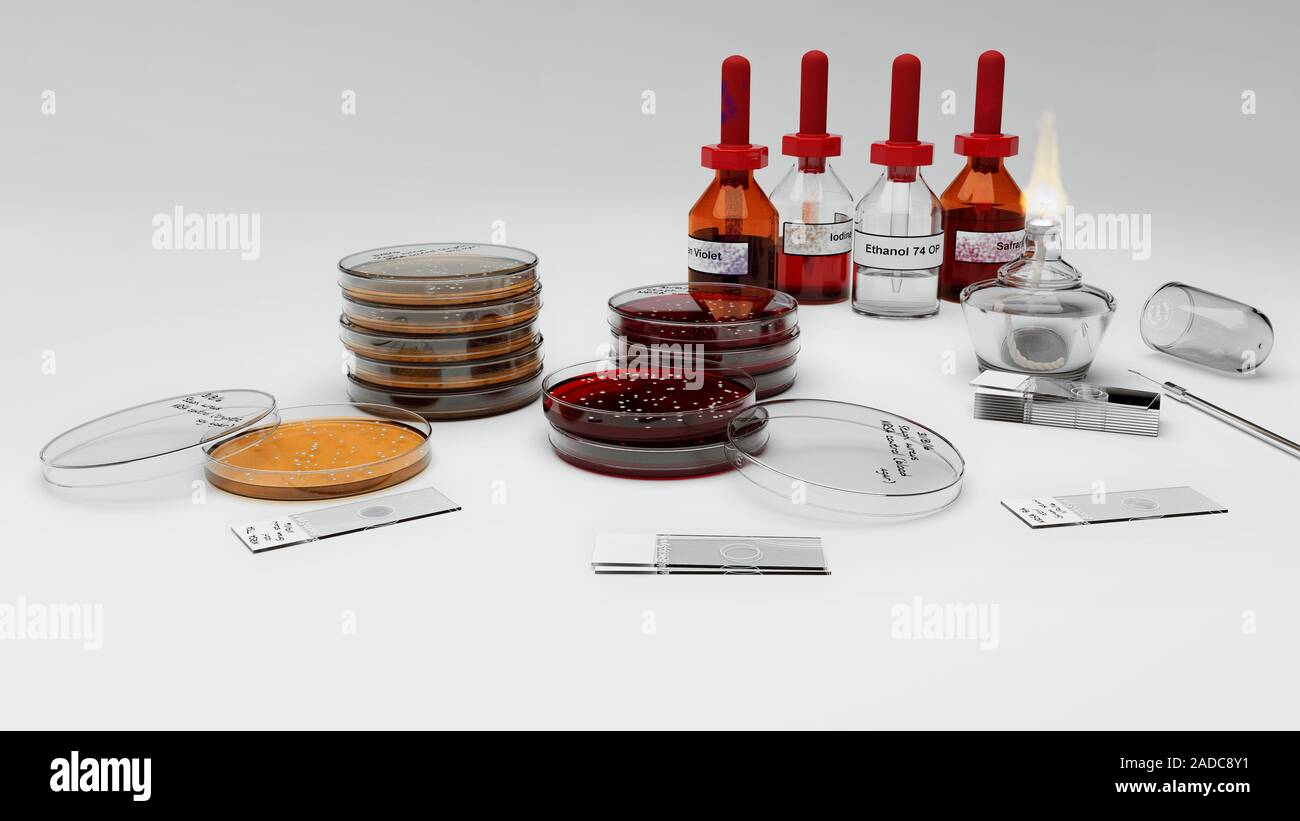 Mrsa Lab Machine A laboratory scene depicting control samples of methicillin-resistant ...