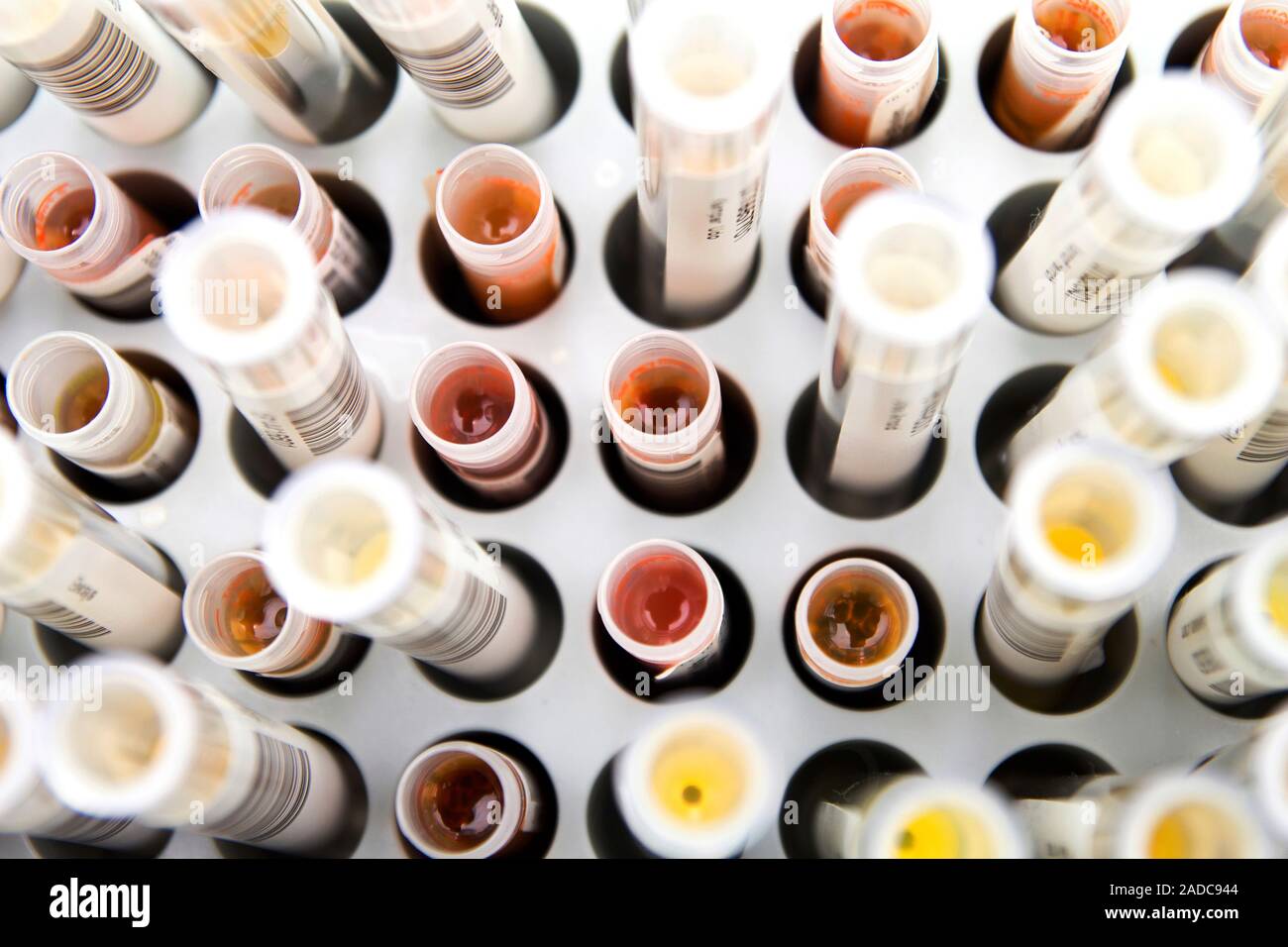 Blood sample analysis. Array of blood samples being analysed in a medical laboratory. These are