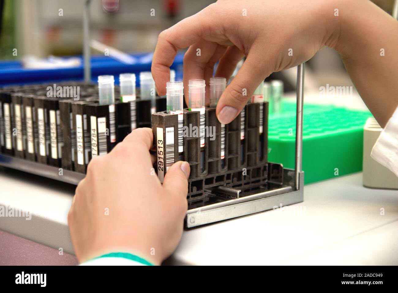 Blood sample analysis. Blood samples being analysed in a medical laboratory. These blood samples