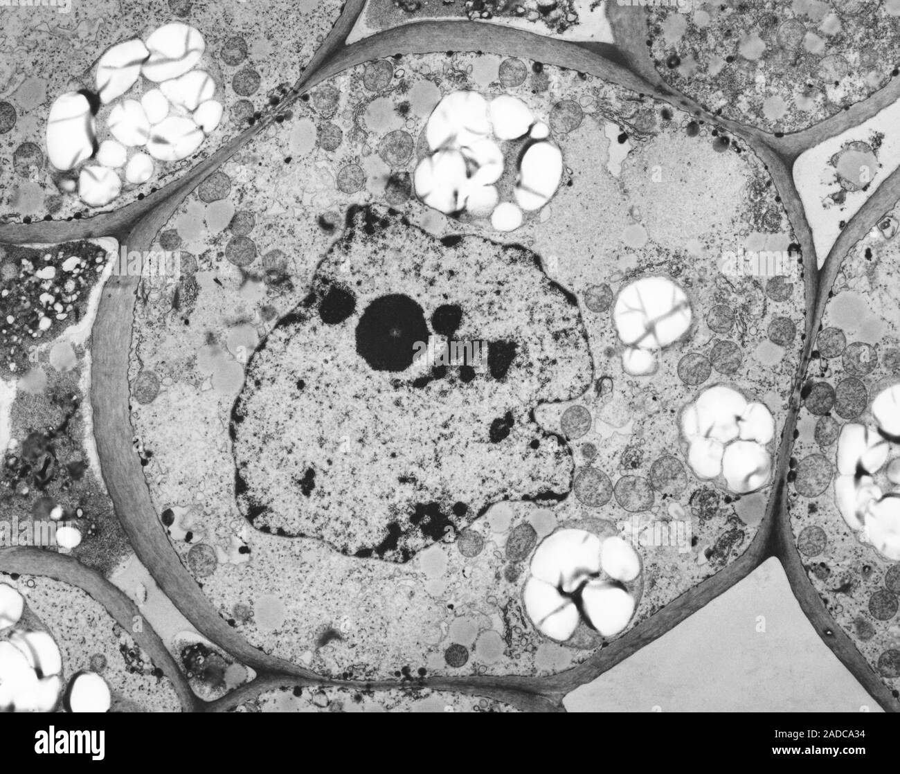 Plant parenchyma cell nucleus (arum or voodoo lily, Sauromatum guttatum