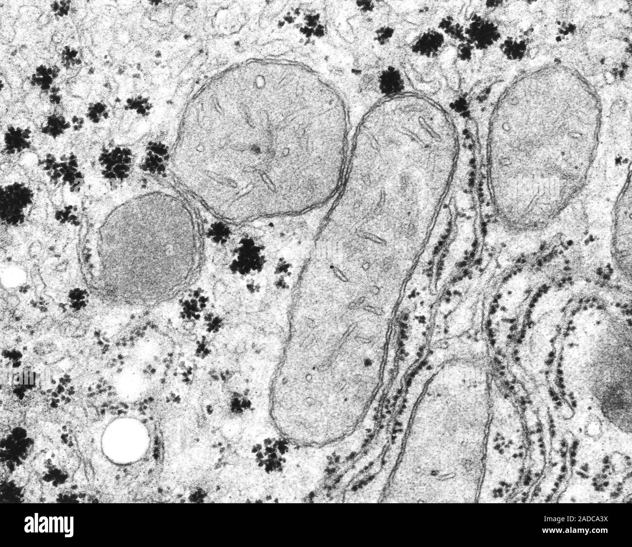 Cellular organelles from a hepatocyte (liver cell) mitochondria
