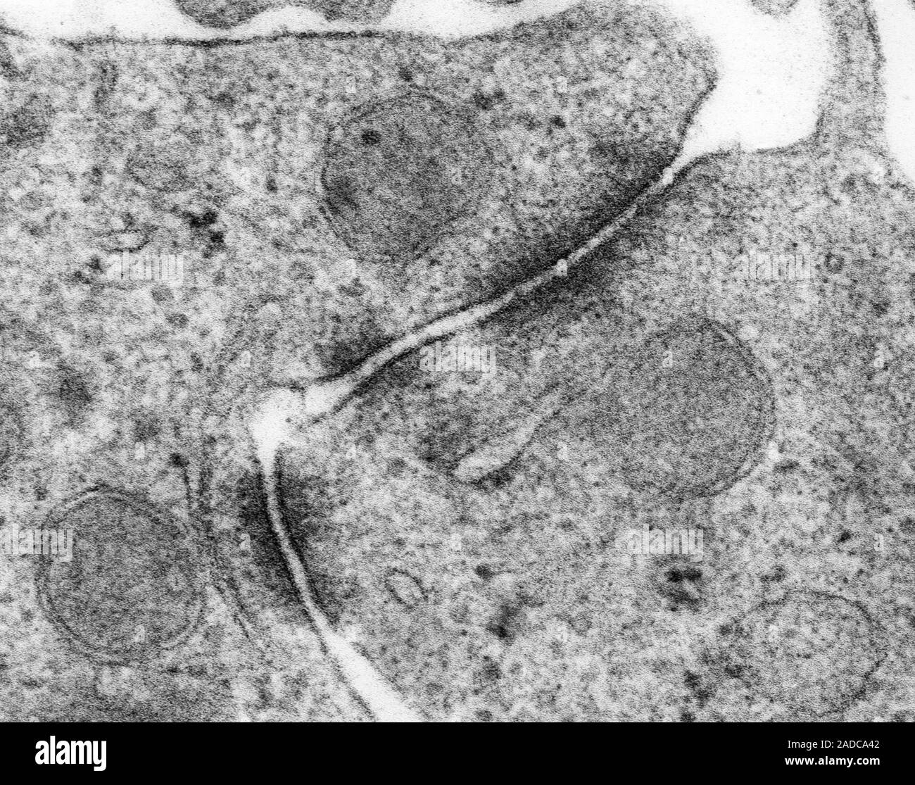 Zonula adherens between epithelial cells (central nervous system