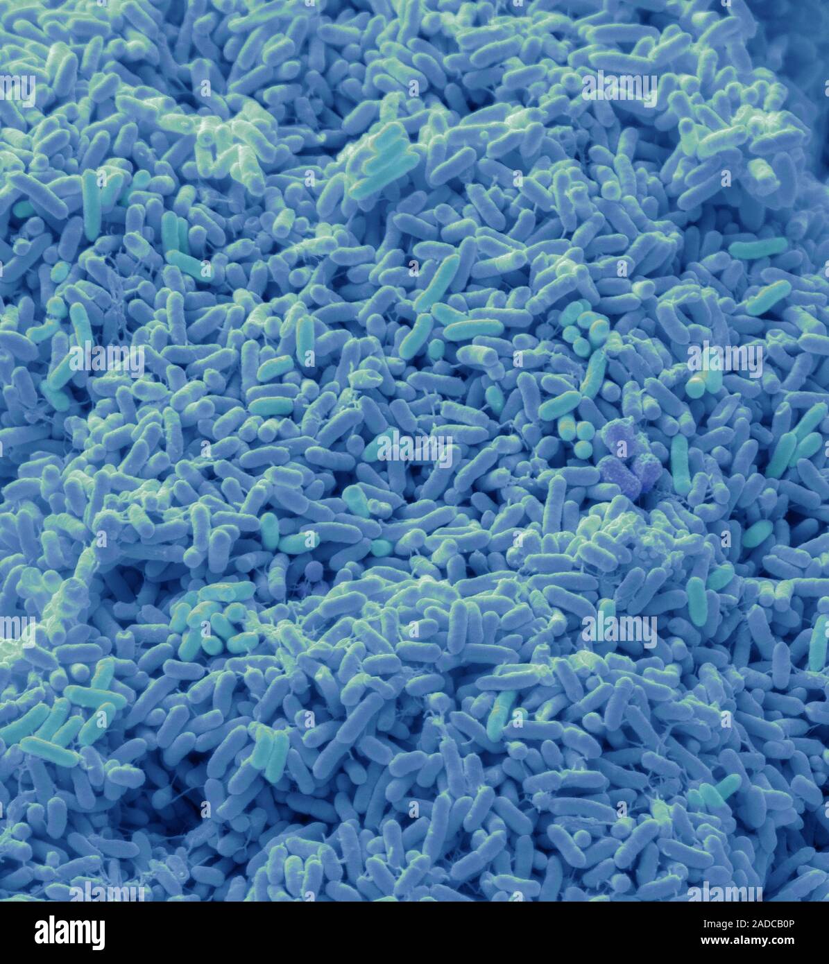 Bacterial culture from a trainer. Scanning electon micrograph (SEM) of