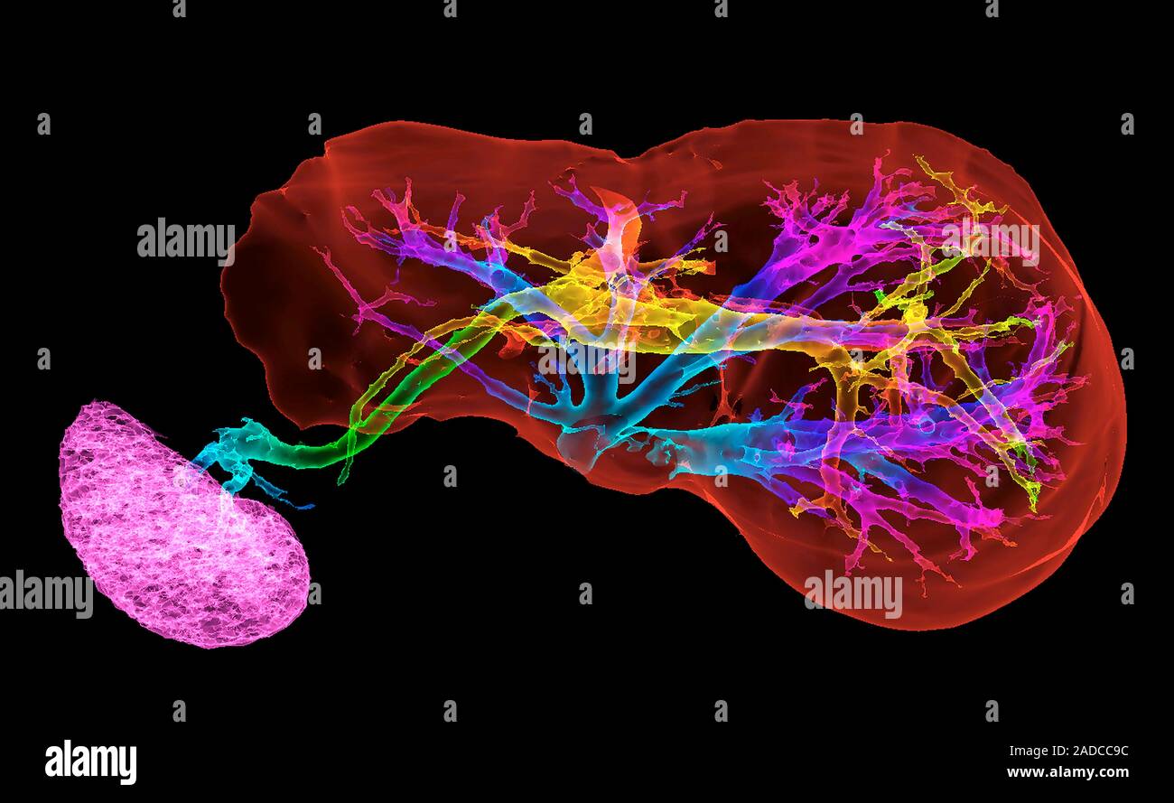Liver and spleen and blood vessels, 3D coloured computed tomography (CT