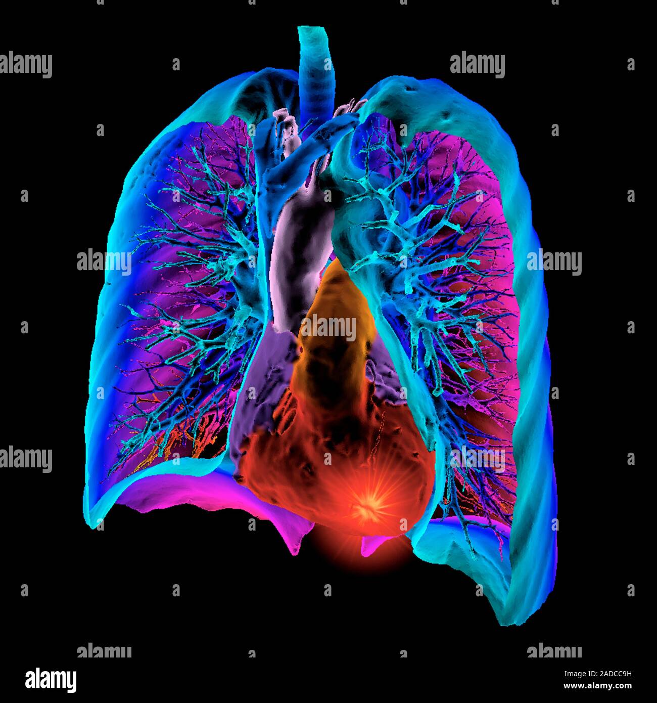 Heart and lungs, 3D coloured computed tomography (CT) scan. The heart
