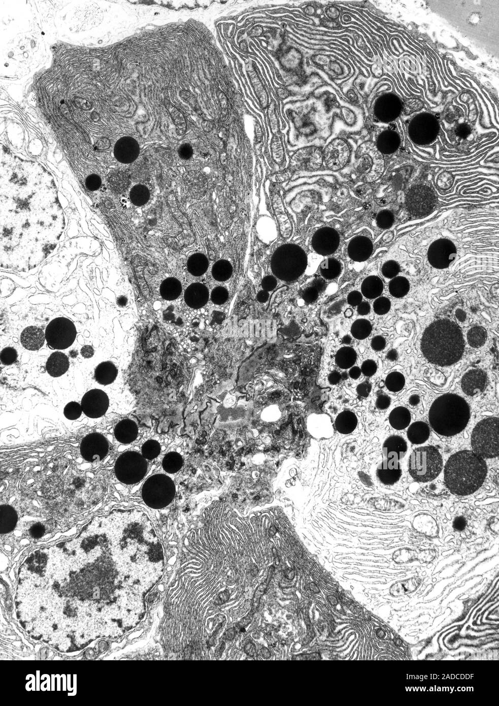 Pancreas tissue, transmission electron micrograph (TEM). The pancreas