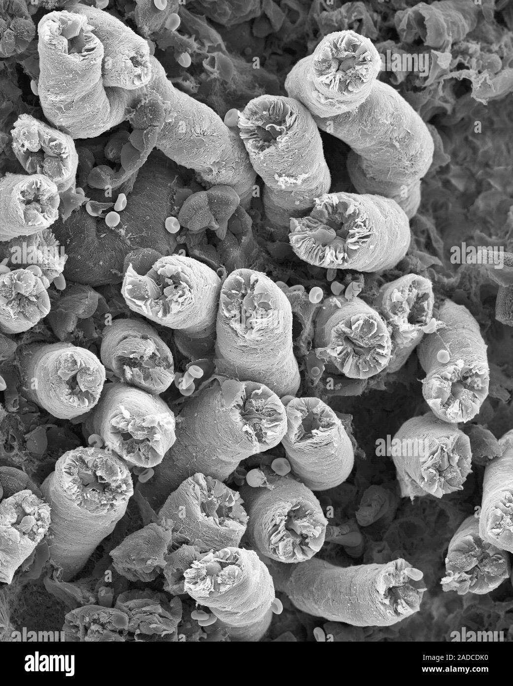 Kidney uriniferous filtration tubules (nephrons), scanning electron