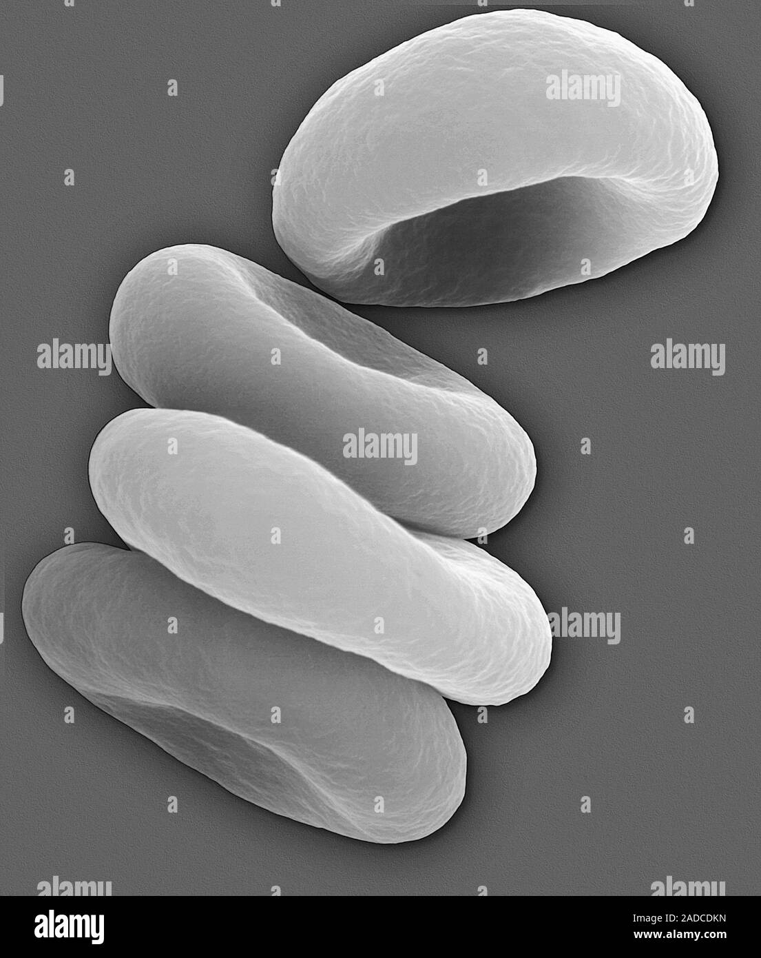 Red blood cells in the Rouleau formation, scanning electron micrograph