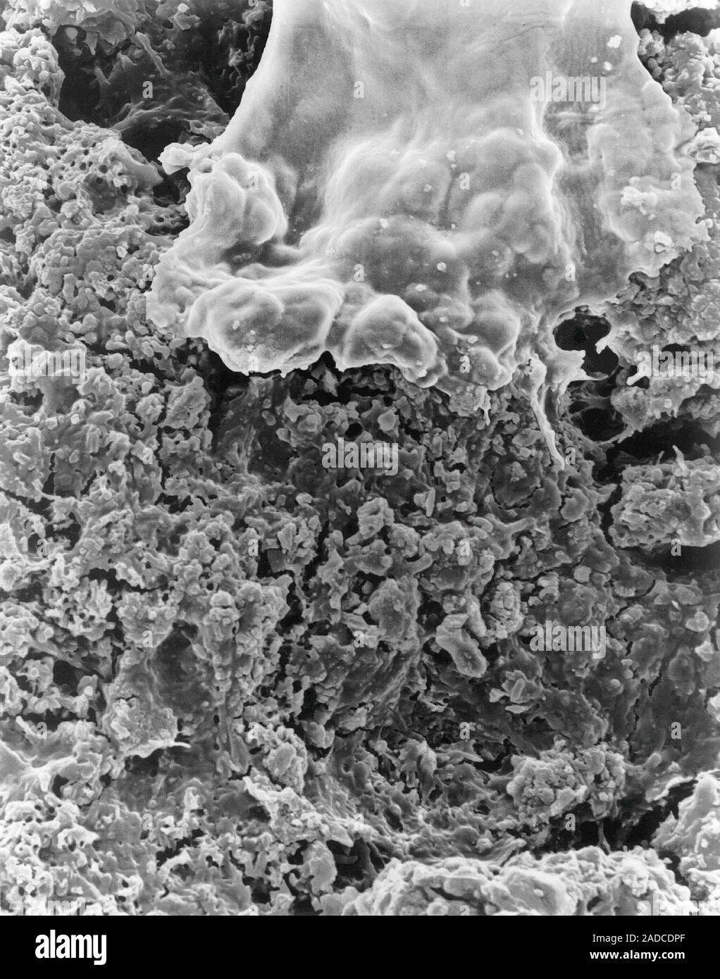 Human tooth with an accumulation of bacterial plaque (smooth areas) and