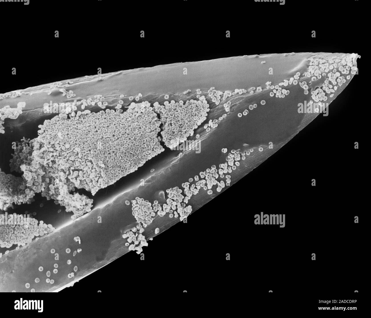 Hypodermic needle (26 gauge) and human blood, scanning electron
