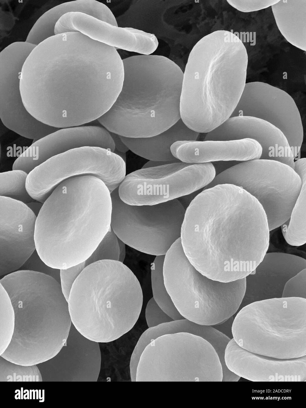 Human red blood cells in physiological isotonic saline solution (0.9