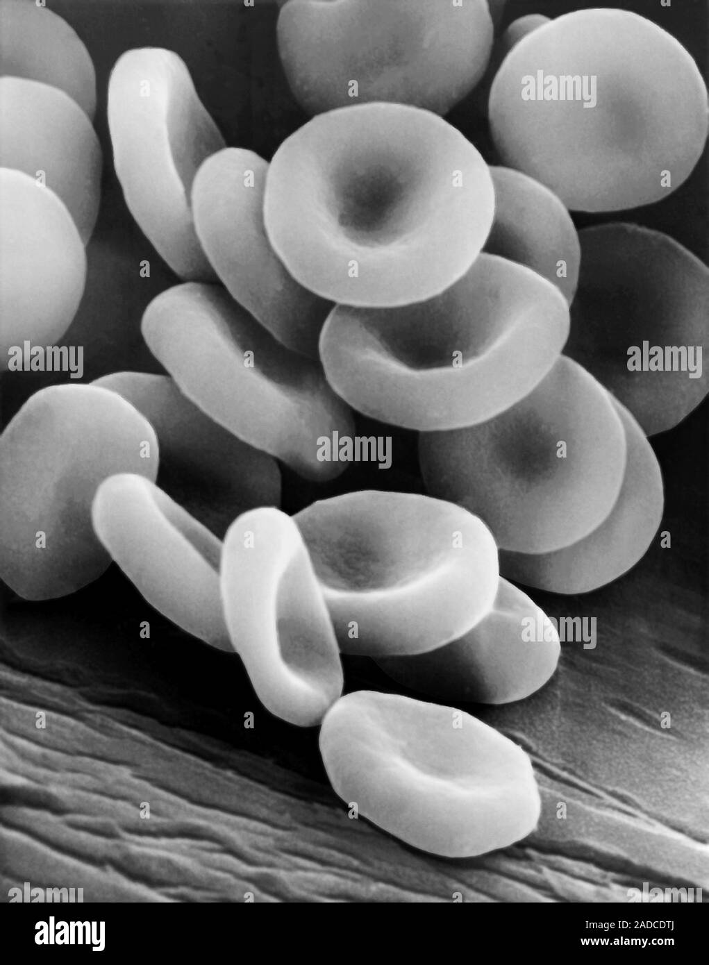 Human red blood cells on a blood vessel wall, scanning electron