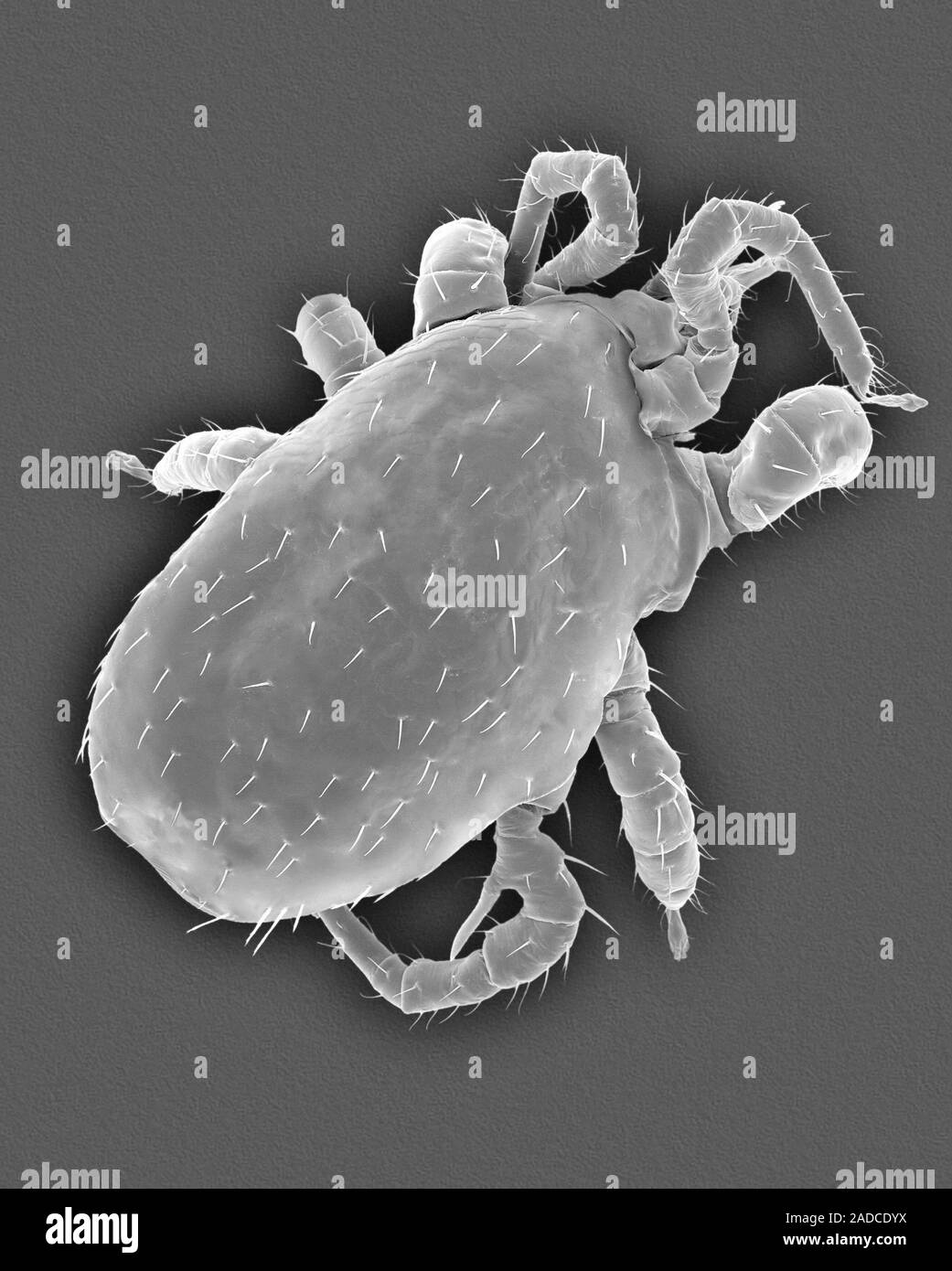 Scanning electron micrograph (SEM) of Bat mite (unknown genus). This