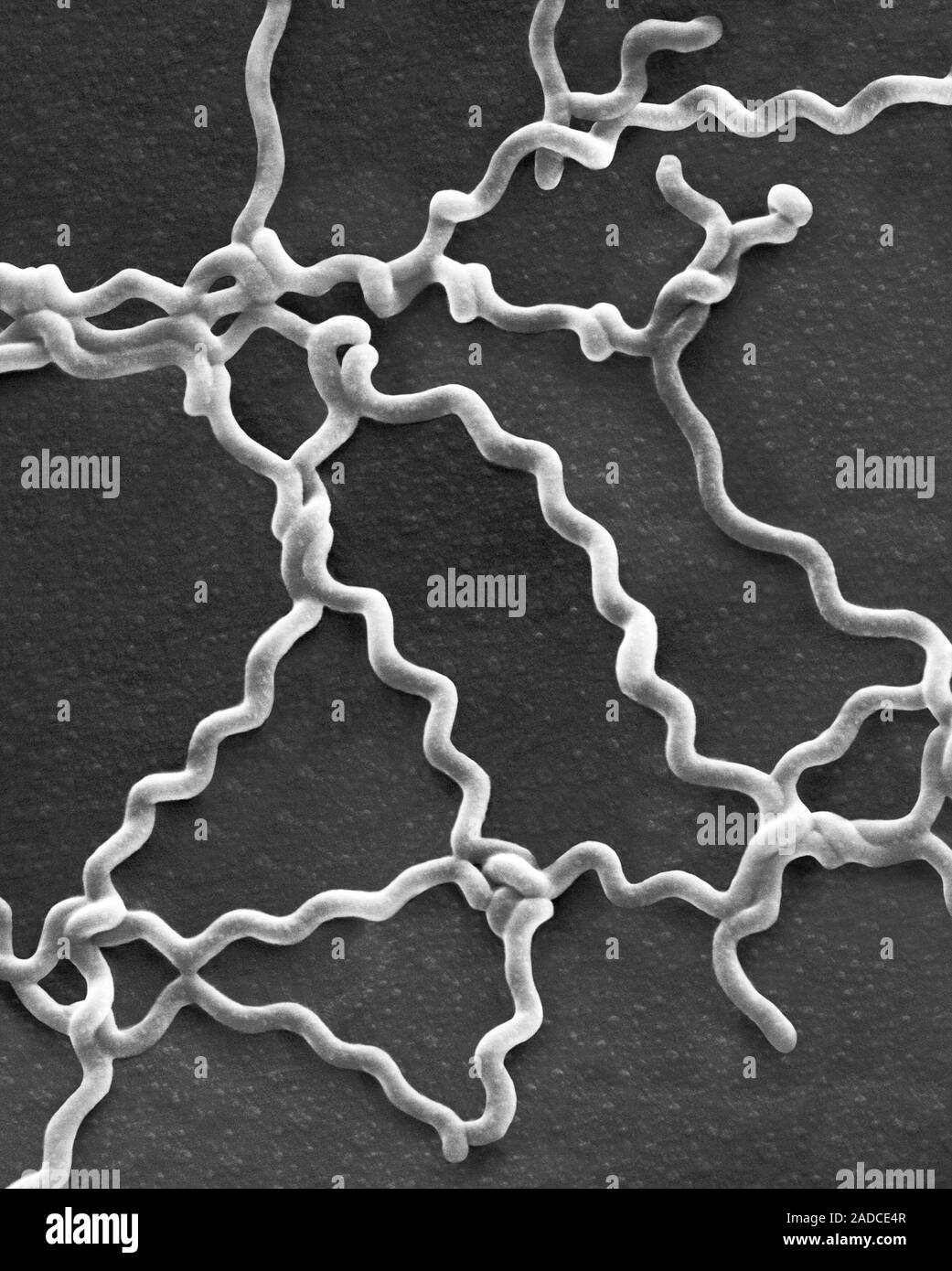 Scanning electron micrograph (SEM) of Leptospira interrogans spirochete ...