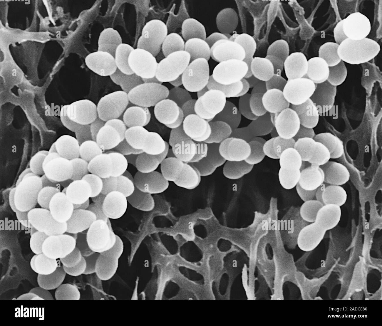 Бактерия золотой стафилококк. Золотистый стафилококк вид. Метициллин-резистентный золотистый стафилококк. Золотистый стафилококк вид. S.
