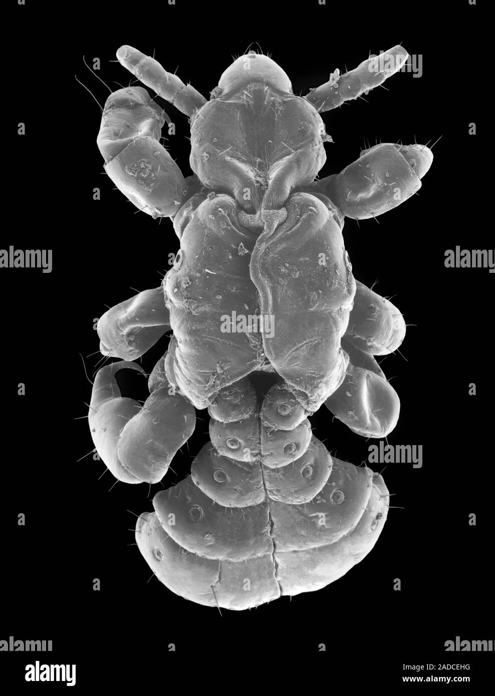 Scanning electron micrograph (SEM) of Human head louse (Pediculus ...