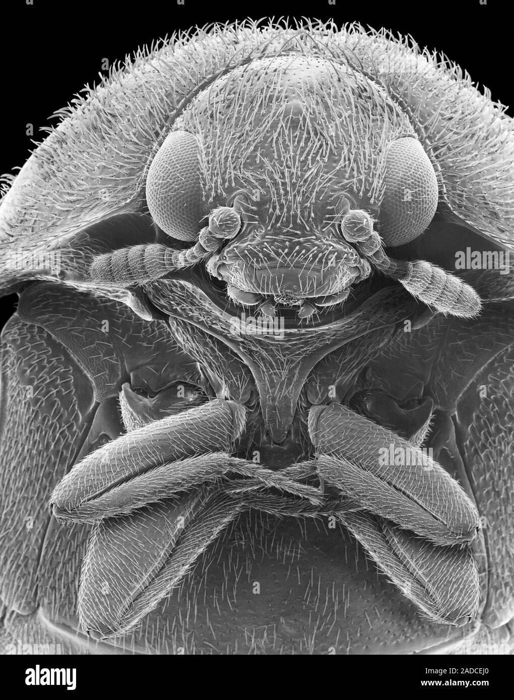 Scanning electron micrograph (SEM) of the head and thorax of a black