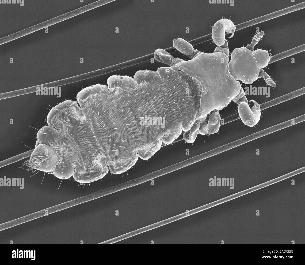 Scanning electron micrograph (SEM) of Human head louse on human hair