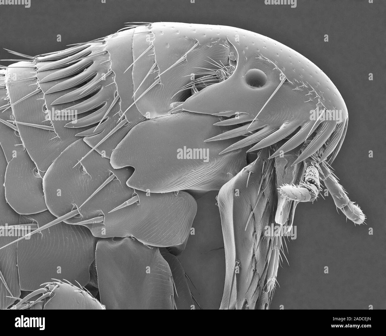 Scanning electron micrograph (SEM) of a common dog flea head