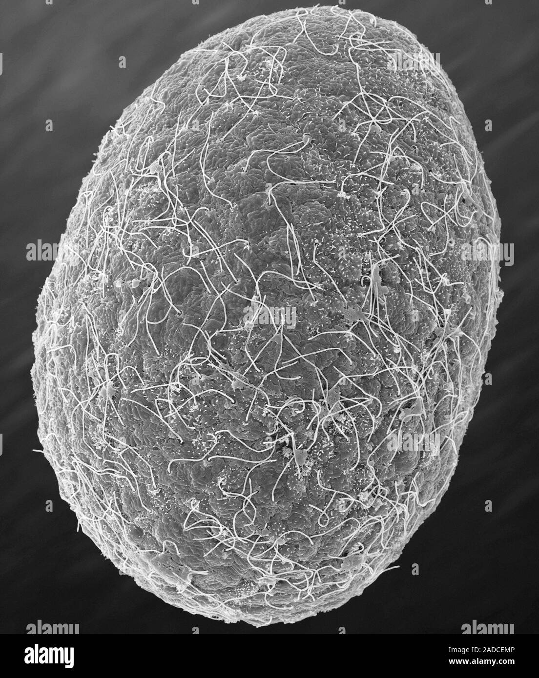 Scanning electron micrograph (SEM) of Larva stage (planula) of a box
