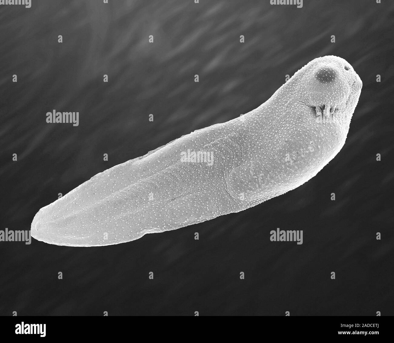 Scanning electron micrograph (SEM) Tadpole of the African clawed frog ...