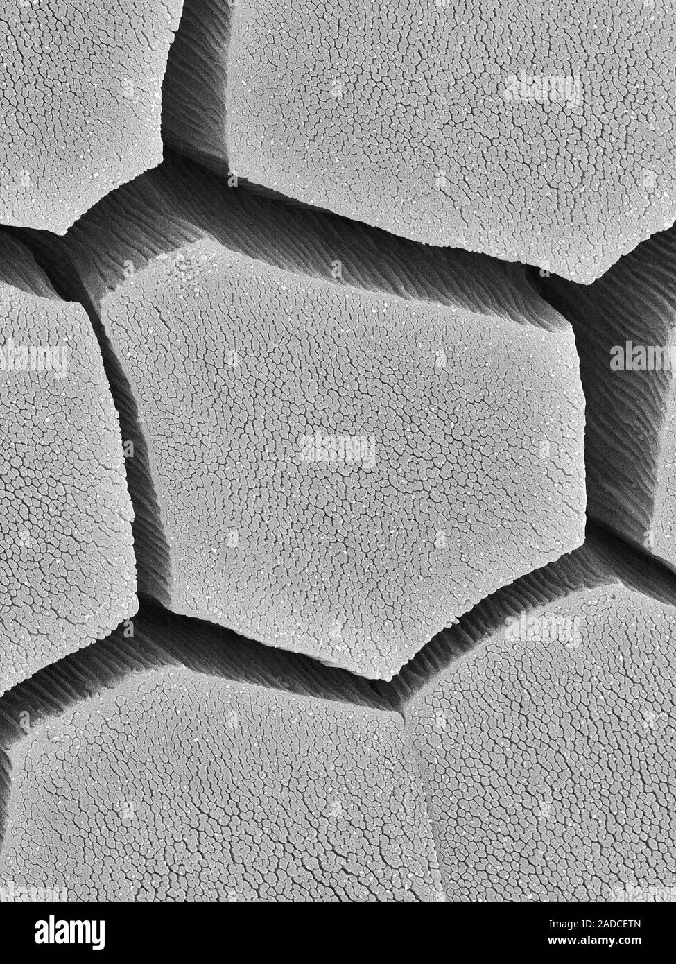 Scanning electron micrograph (SEM) Coqui frog toe pad