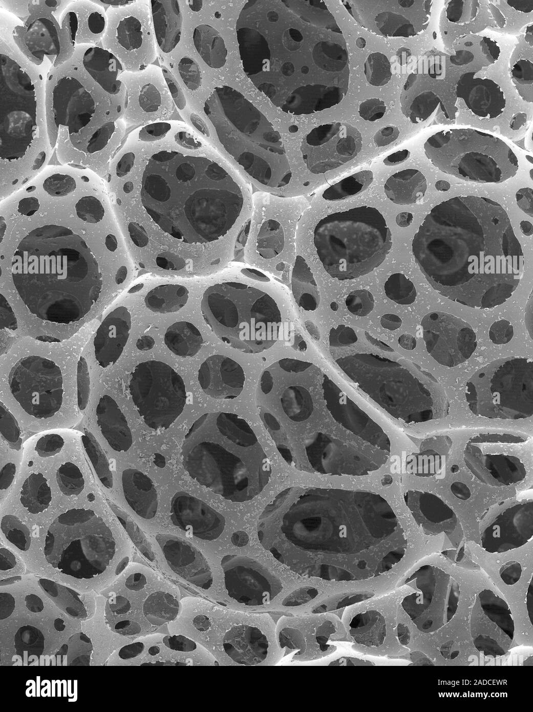 Scanning electron micrograph (SEM) of Fine silica (glass) reticulate ...