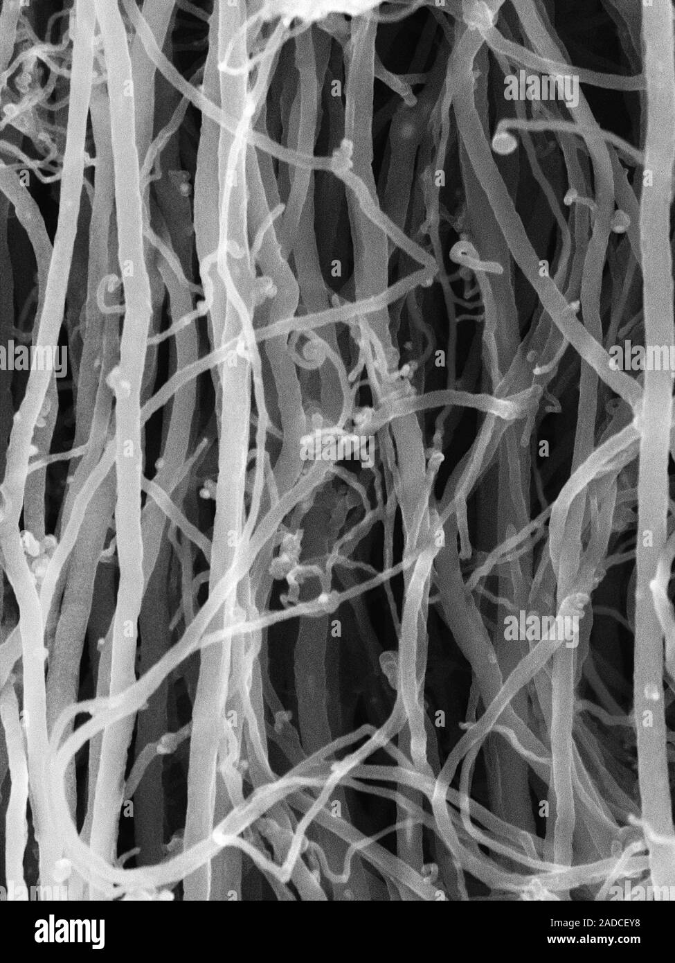 Scanning electron micrograph (SEM) of carbon nanotubes (single and ...