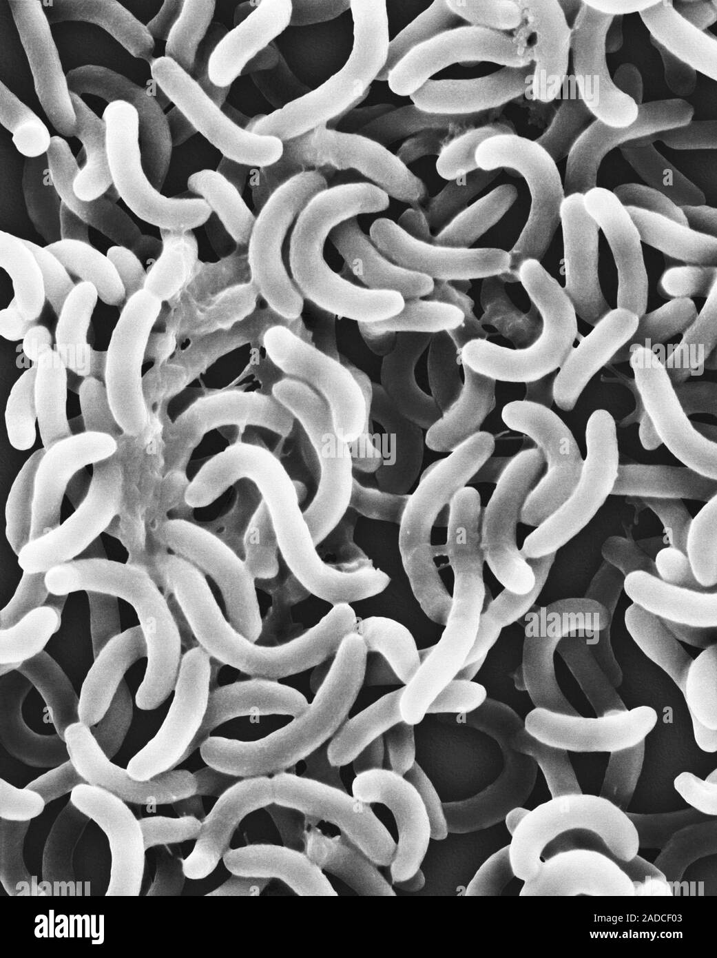 Scanning electron micrograph (SEM) of Vibrio cholerae bacteria. These ...