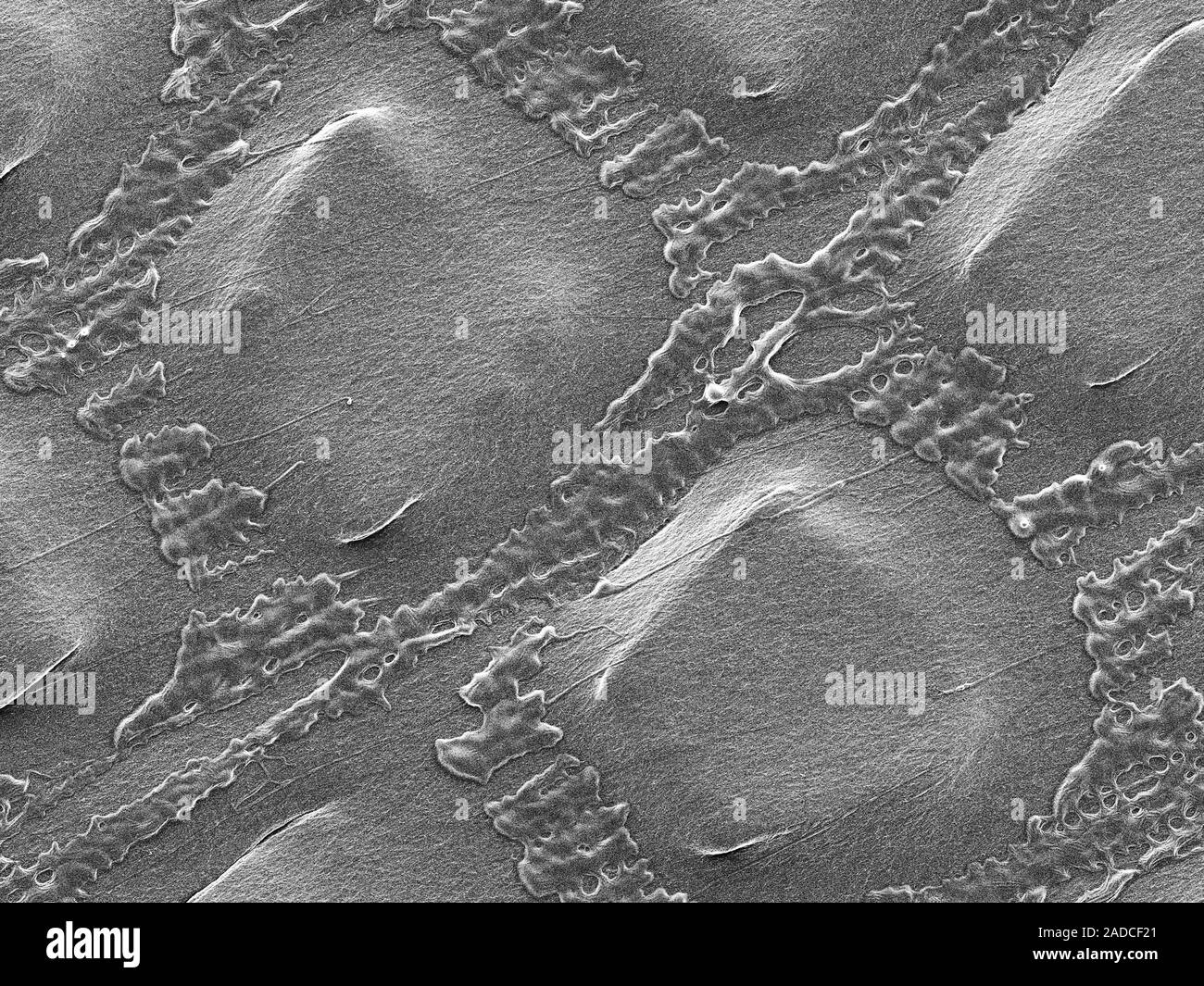 https://c8.alamy.com/comp/2ADCF21/scanning-electron-micrograph-sem-of-plastic-wrap-glad-pressn-seal-plastic-wrap-is-a-thin-plastic-film-less-than-001mm-in-thickness-that-typica-2ADCF21.jpg