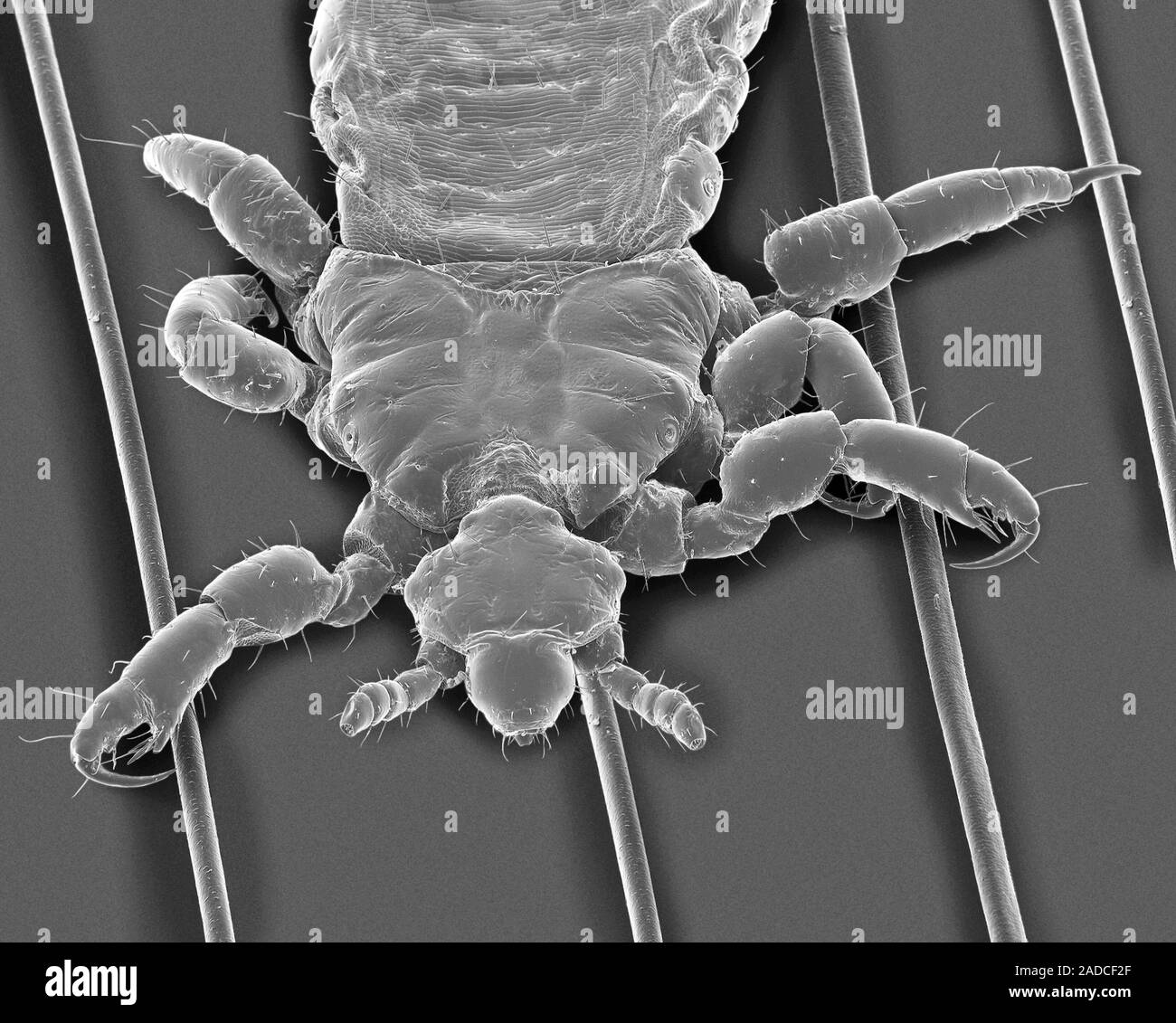 Scanning electron micrograph (SEM) of Human head louse on human hair ...