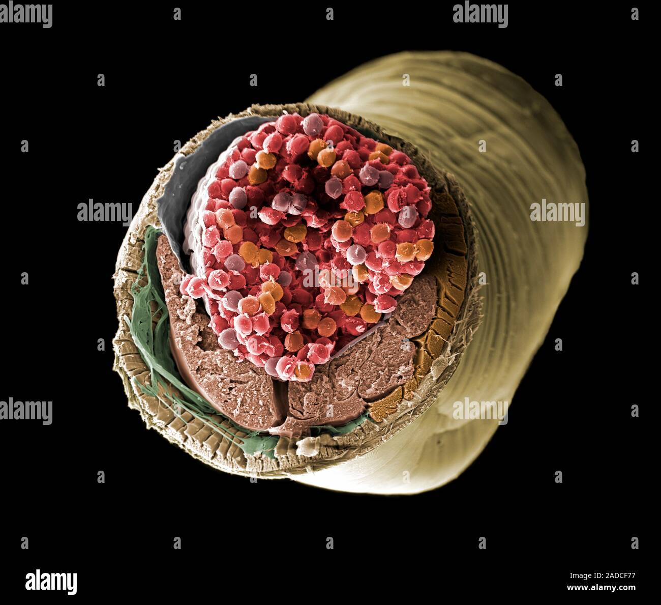 Coloured scanning electron micrograph (SEM) of roundworm (Contracaecum