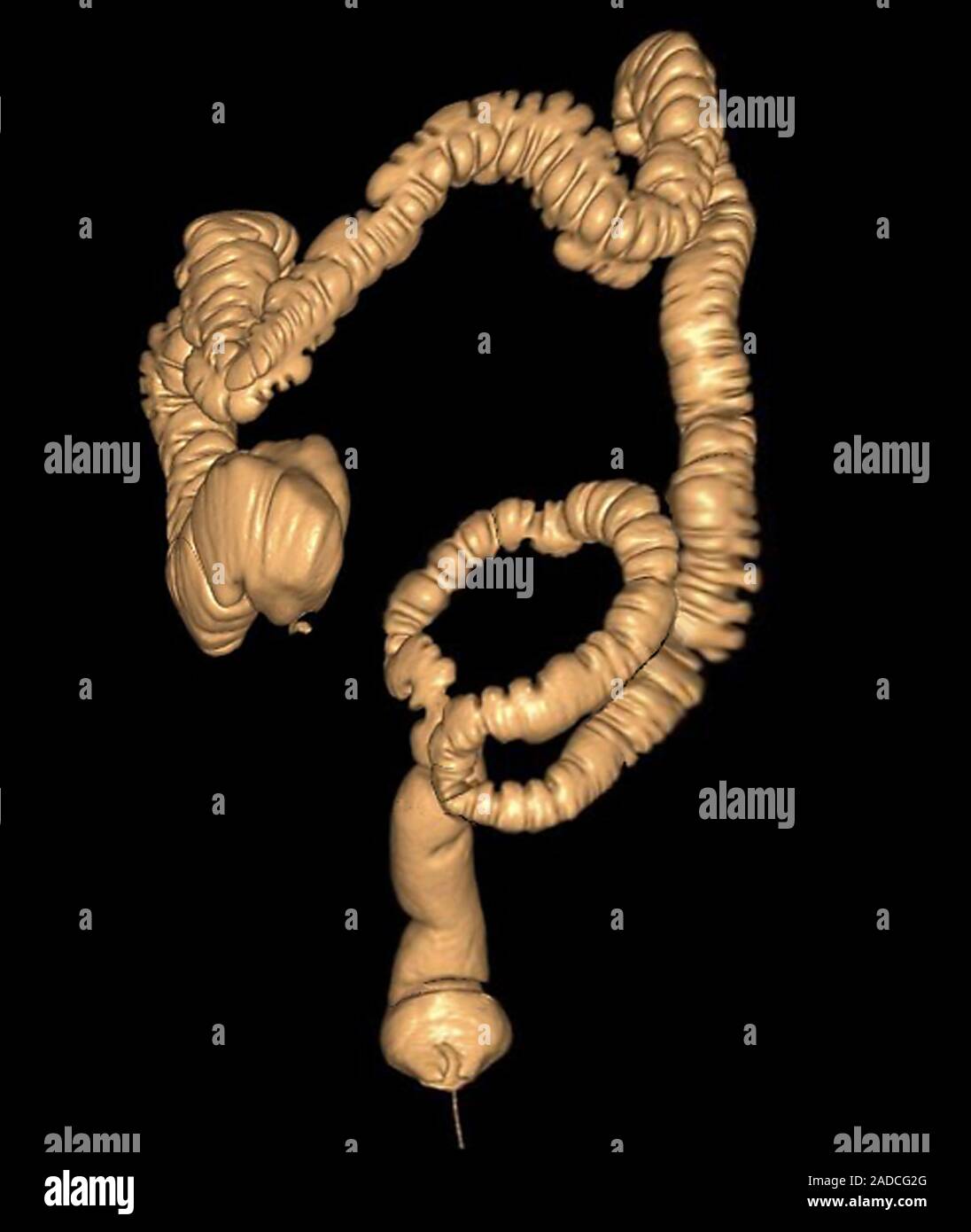 Large intestine. Coloured 3D computed tomography scan of a normal human