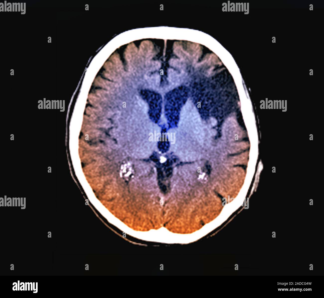 Smith & Mighty – Brain Scan – Vinyl (7