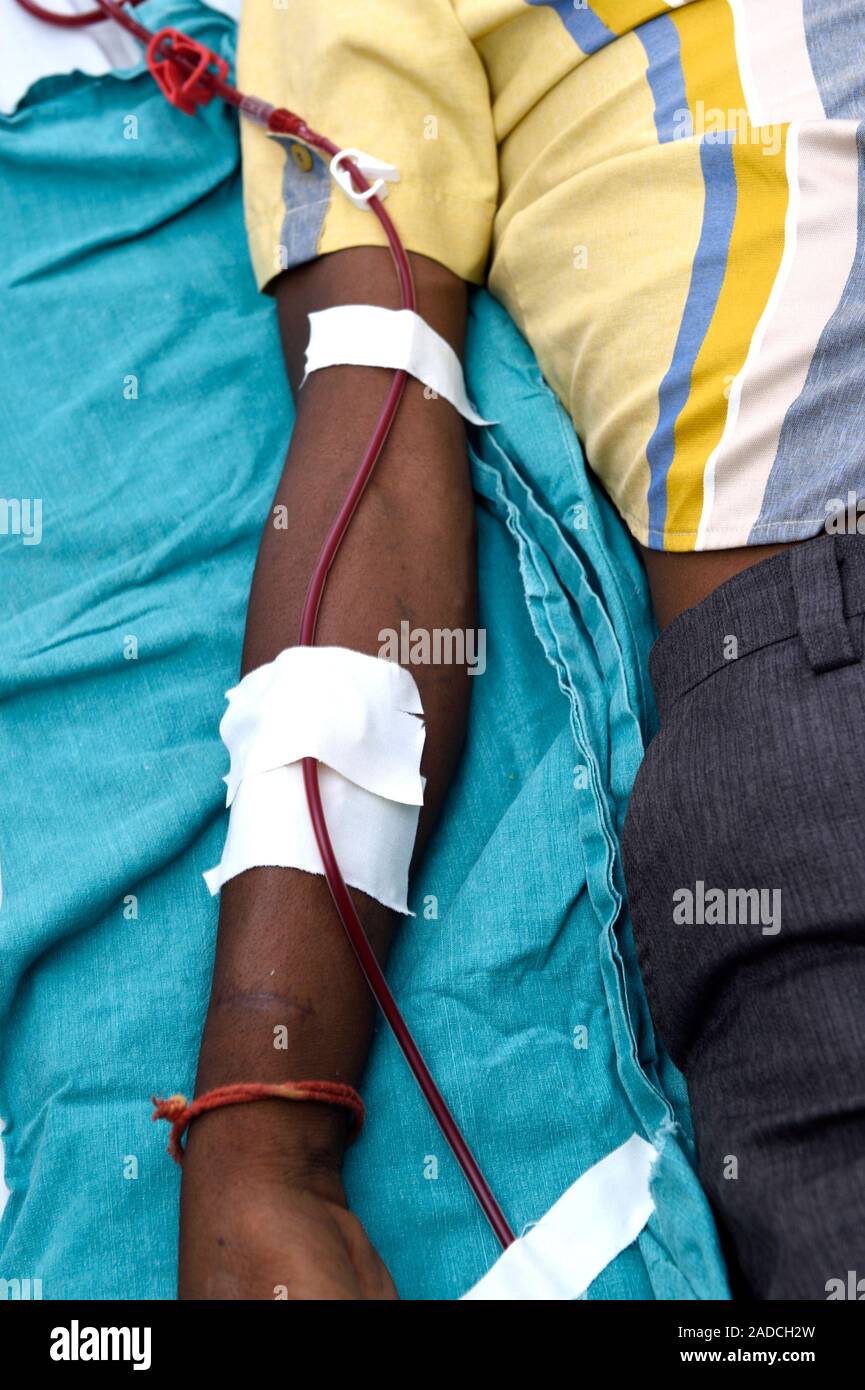 Not for use in Television Kidney dialysis patient. Closeup of the arm