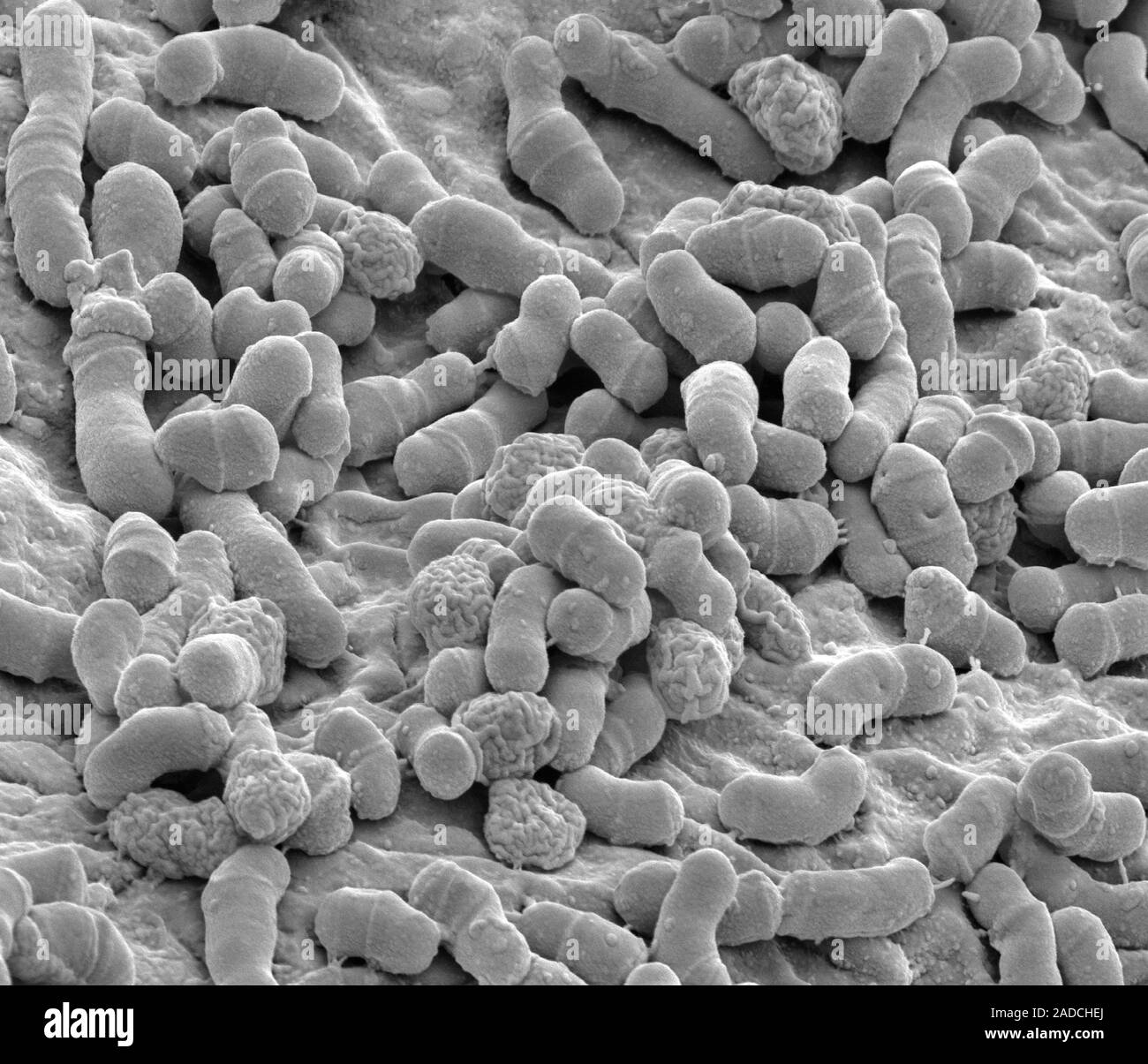 Athlete's foot fungus. Scanning electron micrograph (SEM) of Malassezia