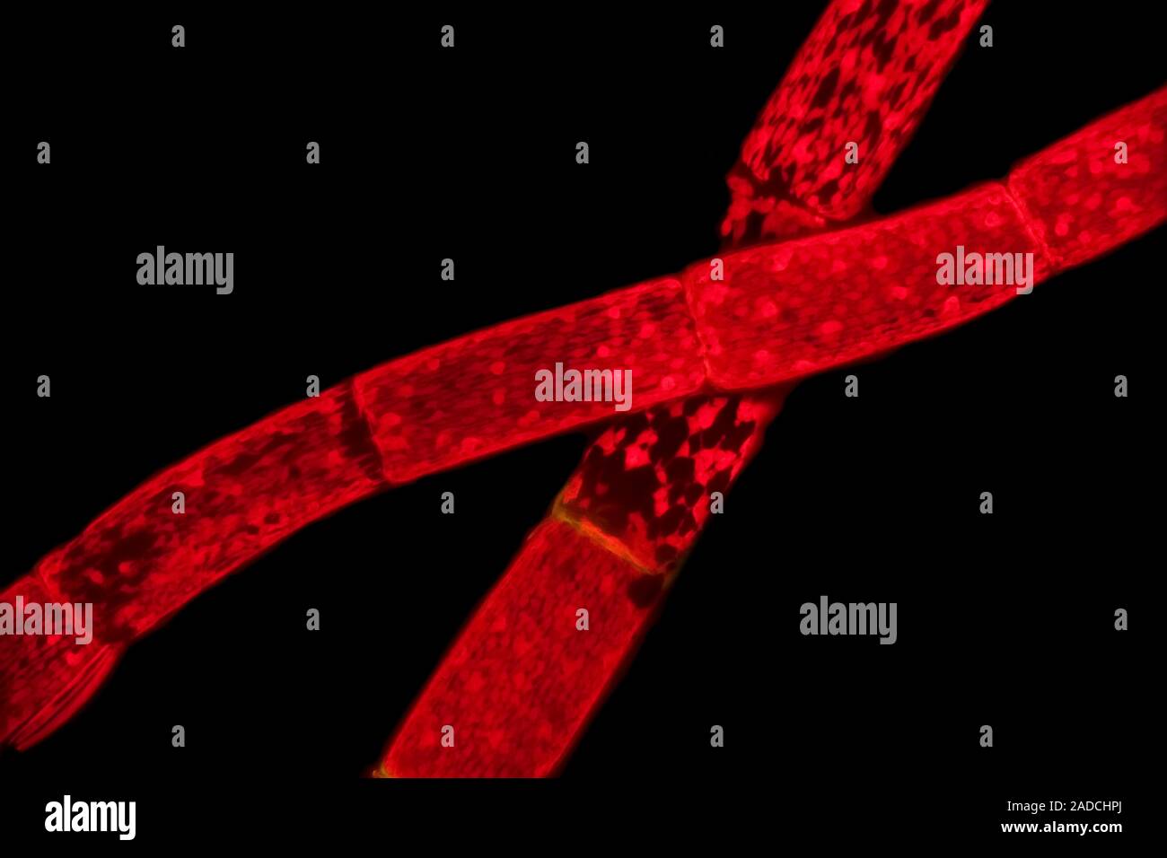 Light micrograph of alga, a freshwater filamentous green alga